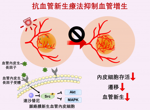 抗血管增生療法通過壓抑與血管內皮生長因子（VEGF）相關的路徑，抑制脈絡膜新生血管形成（CNV）。這項研究首次將抗血管增生藥物和光敏藥物結合製成納米製劑用於黃斑病變治療，為黃斑病變和其他新生血管性眼病的微創療法提供了新的方向。
 